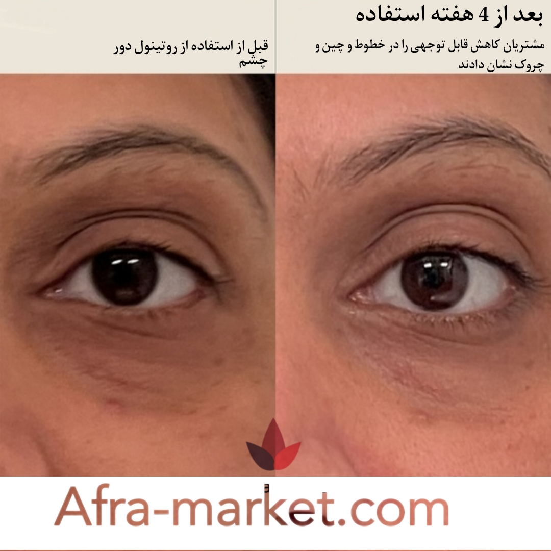 html <img src="your-image-source.jpg" alt="تأثیر استفاده از رتینول بر پوست، شامل کاهش خطوط ریز، بهبود کلاژن سازی و روشنتر شدن رنگ پوست">