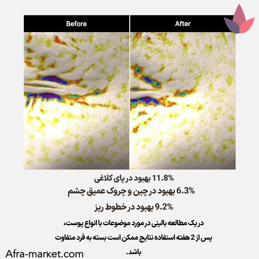 <img src="https://afra-market.com/medicube-deep-lifting-peptide-eye-cream" alt="تحقیقات علمی از عملکرد کرم دور چشم جوانساز و لیفتینگ پپتاید مدی کیوب: آزمایشات نشان داده‌اند که پپتایدهای موجود در این کرم به تقویت کلاژن و الاستیسیته پوست کمک می‌کنند، کاهش چین و چروک و پف اطراف چشم را بهبود می‌بخشند و به روشن‌تر شدن پوست کمک می‌کنند، نتیجه‌بخش در مدت زمان کوتاه، محصول اصل برند Medicube، خرید از افرا مارکت">